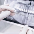 Why Would a Dentist Refer You to a Specialist?